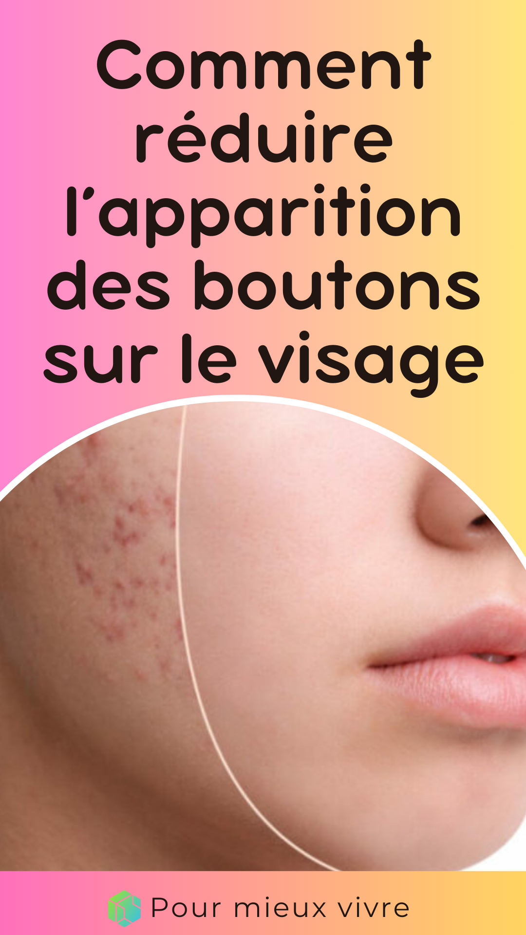 Comment réduire l’apparition des boutons sur le visage